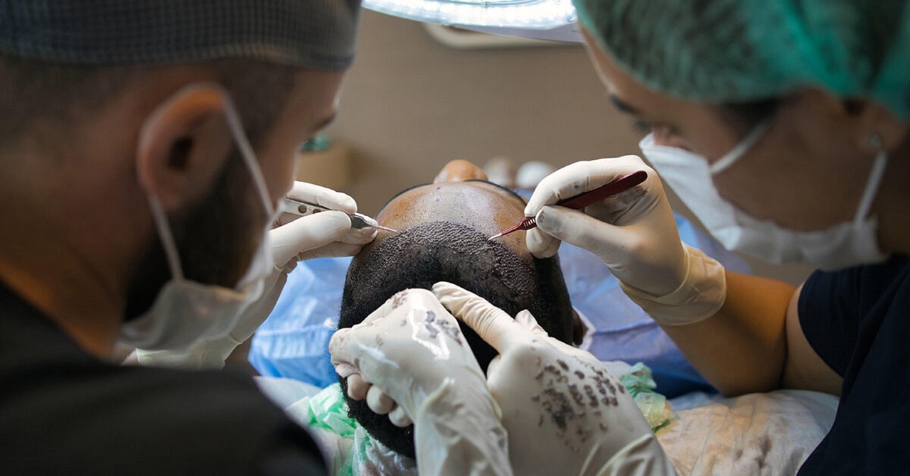 hair loss treatment scalp