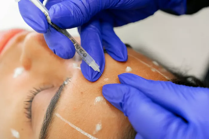 botox facial treatment
